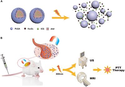 Near-Infrared Responsive Phase-Shifted Nanoparticles for Magnetically Targeted MR/US Imaging and Photothermal Therapy of Cancer